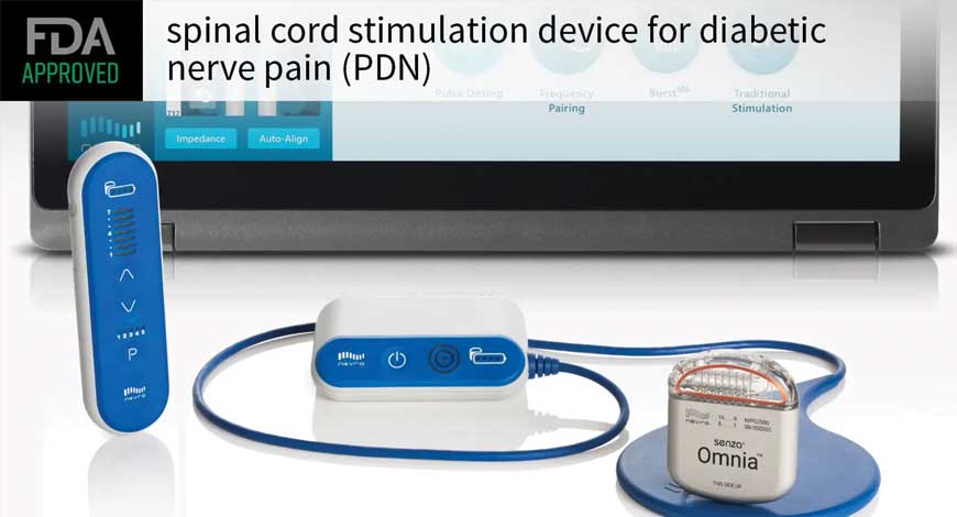 abbott medical spinal cord stimulation field shaping