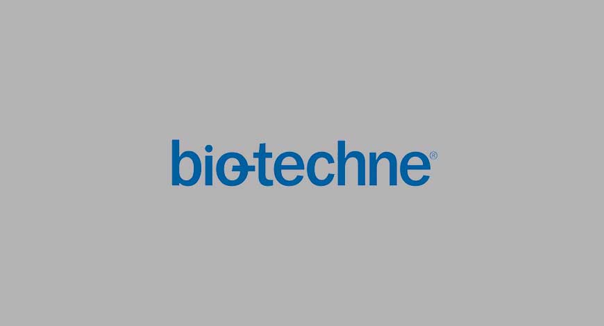 Bio-Techne releases fourth quarter fiscal 2021 results - Medical Buyer