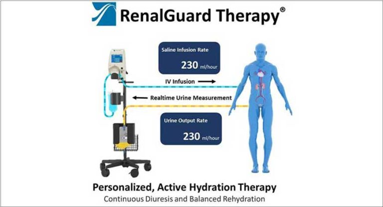 RenalGuard Therapy Receives FDA Breakthrough Device Designation ...