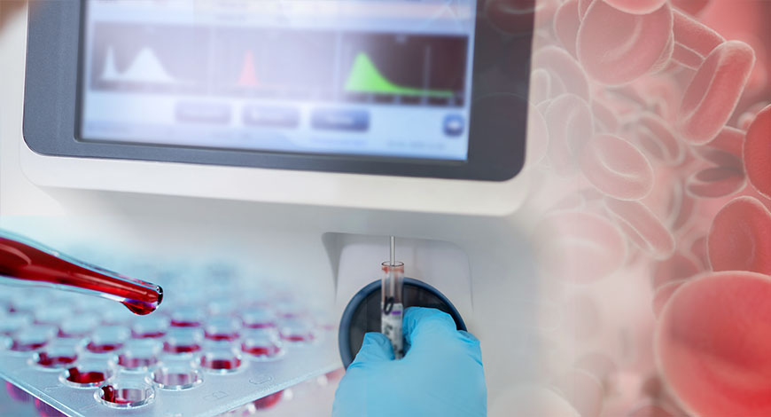 Blood gas and electrolyte analyzers