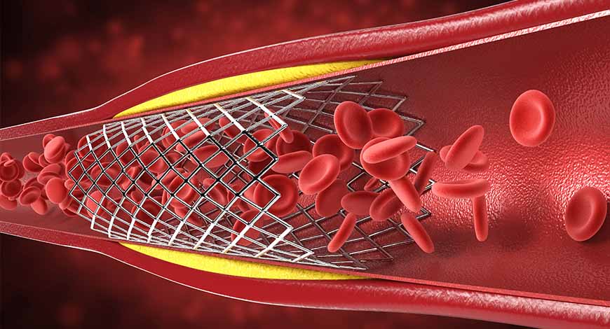 Coagulation instruments and reagents