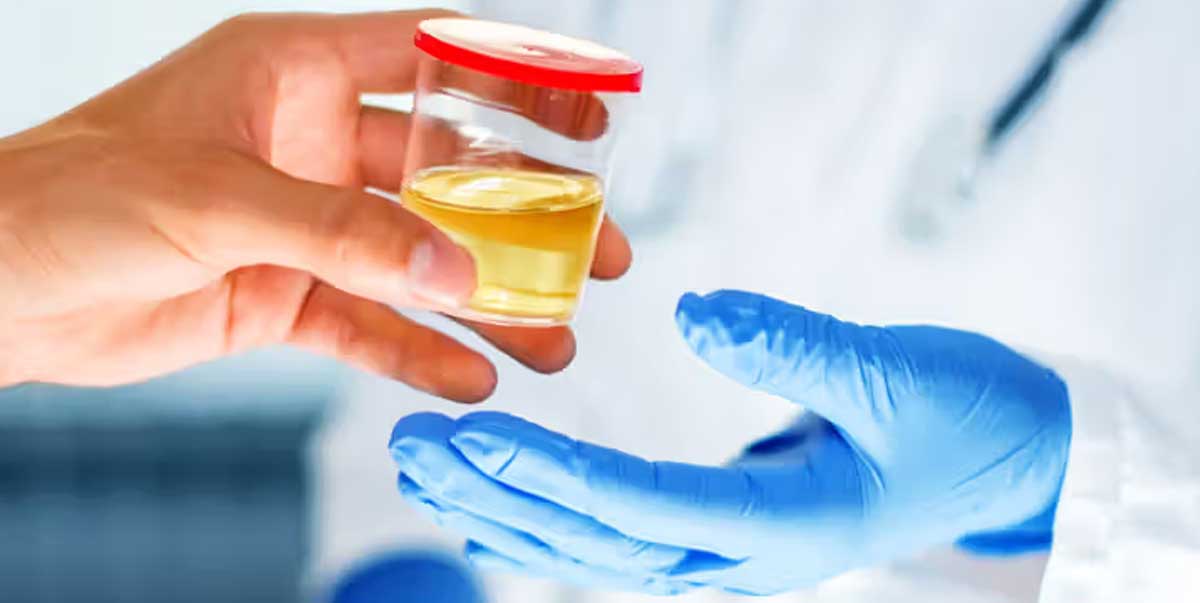 Microalbumin checker (POCT)