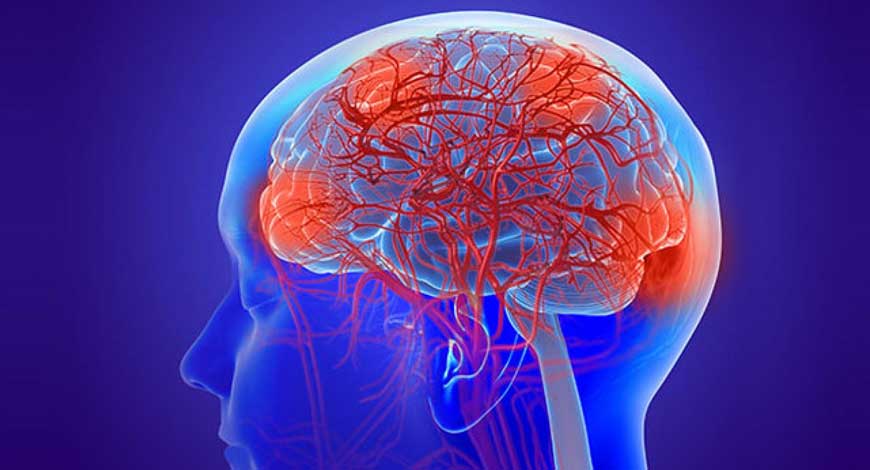 Understanding dementia care