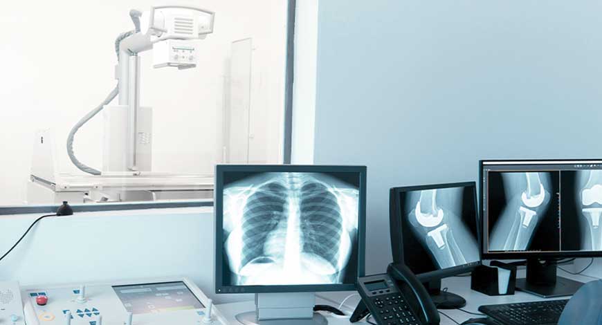 X-ray equipment digital radiography